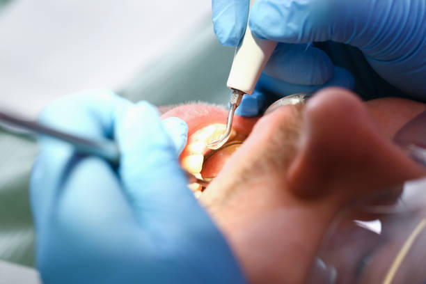 Fast & Reliable Emergency Dental Services in ND