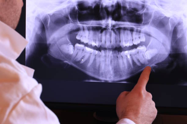 Best Urgent Dental Care in Beach, ND