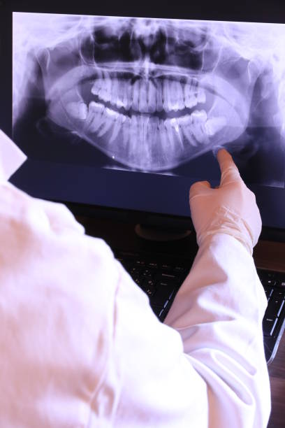 Best Emergency Tooth Extraction in Beach, ND