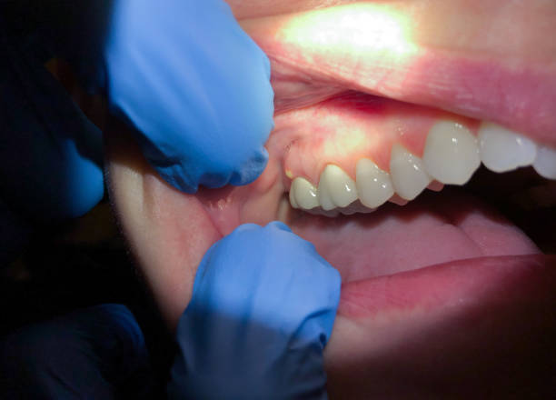 Best After-Hours Emergency Dentist in Beach, ND